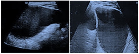  Images of Ultrasonography at one year of age.