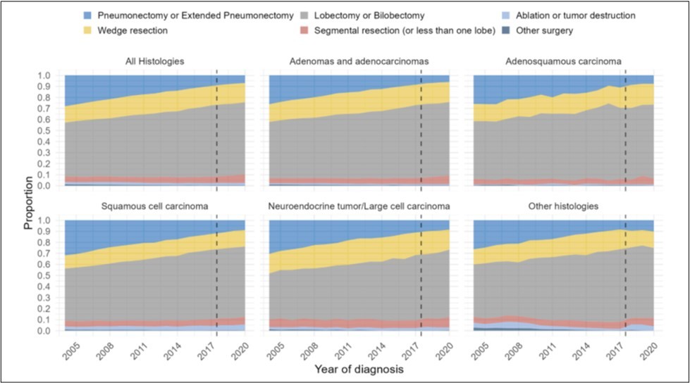 Distribution of type of surgical treatment performed over time by year of diagnosis from 2004-2020, for (A) all histologies of NSCLC, (B) adenocarcinomas, (C) adenosquamous histology, (D) squamous histology, (E) neuroendocrine histology, and (F) other histologies.