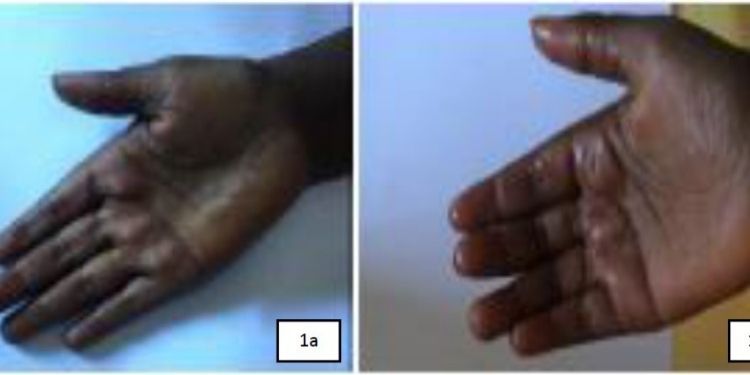 Journal of Pediatric Health and Nutrition-Vitamin B12
