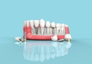 Journal of Dentistry And Oral Implants